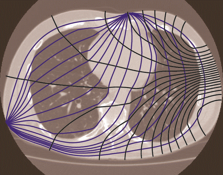 Introduction to Electrical Impedance Tomography – EIT Community Website